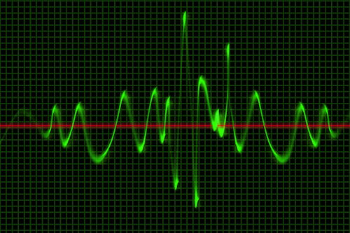 Oscilloscope screen